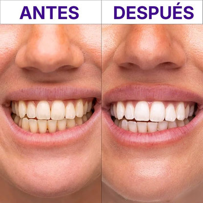 Hismile - Serum V34