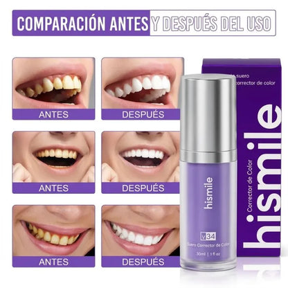 Hismile - Serum V34